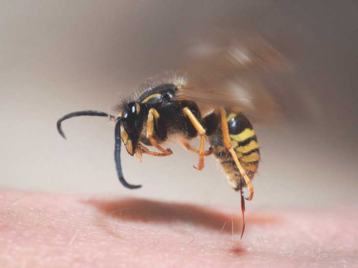 Ezt NE tedd, ha megcsípett a méh, vagy a darázs!