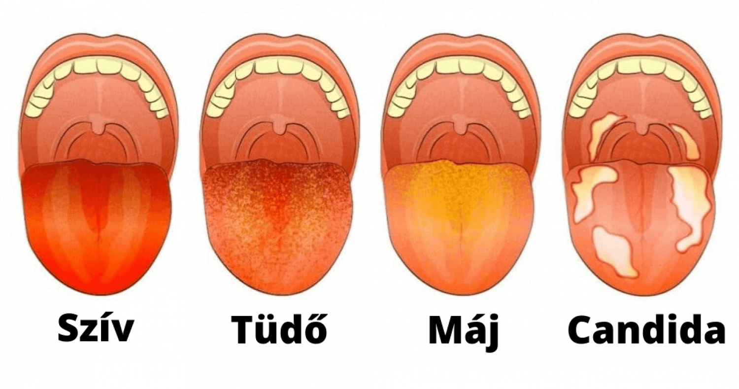 Nyújtsd ki a nyelved - fontos információkat ad az egészségedről